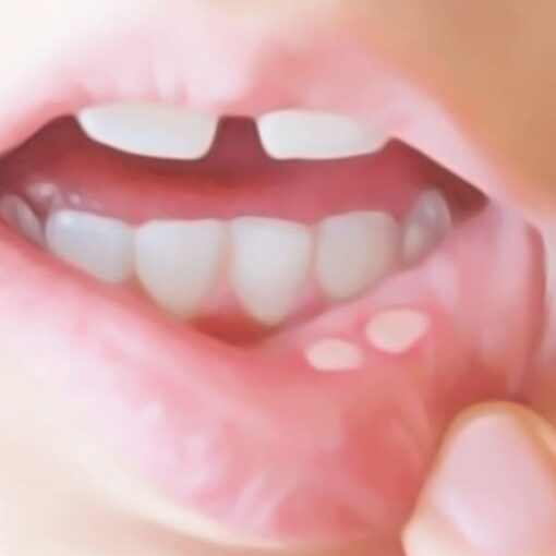 My Image 8