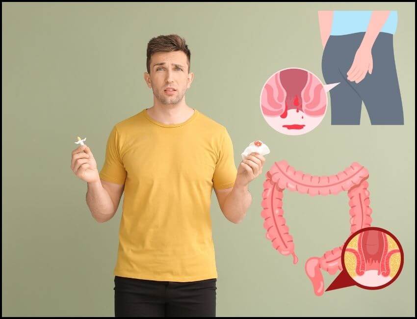 โรคริดสีดวงทวาร