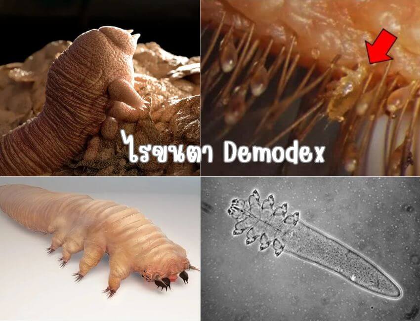 ไรขนตา demodex