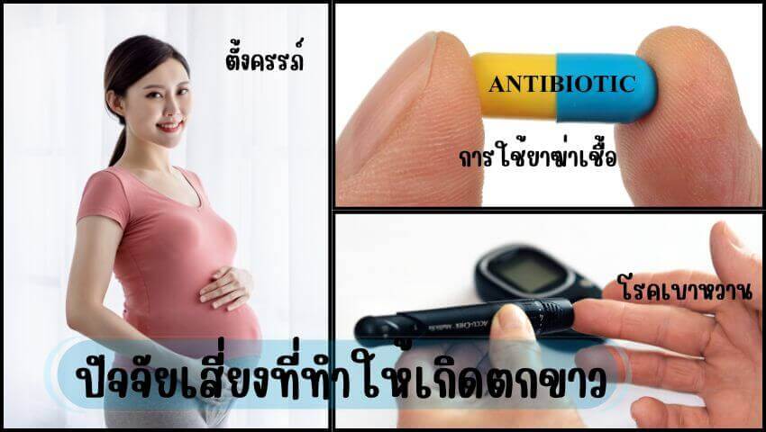 ปัจจัยเสี่ยงทำให้เกิดอาการระดูขาวทั้งแบบติดเชื้อและไม่ติดเชื้อ