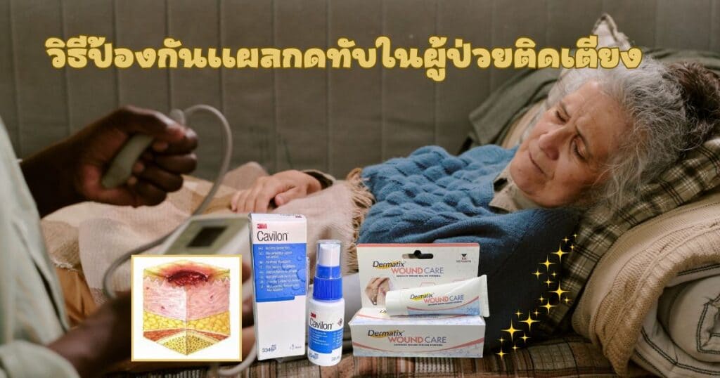 การป้องกันแผลกดทับในผู้ป่วยติดเตียง