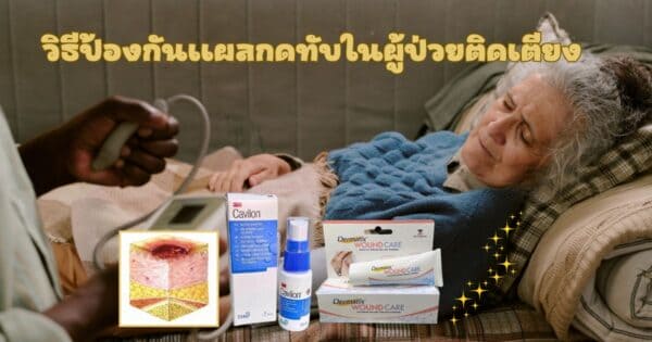 การป้องกันแผลกดทับในผู้ป่วยติดเตียง